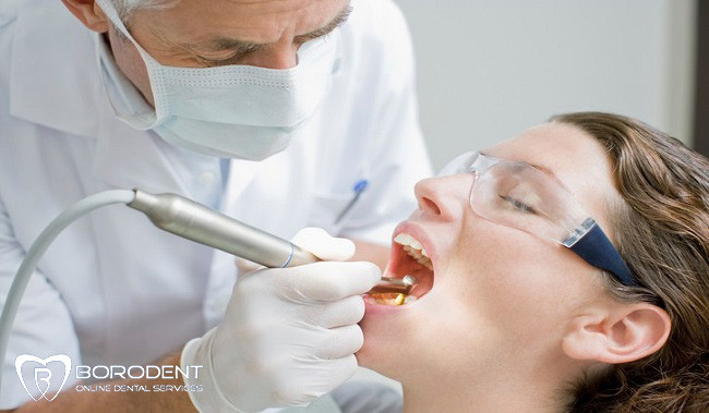 جرم گیری دندان